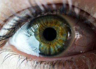 کمیاب ترین رنگ چشم جهان چه رنگی است؟